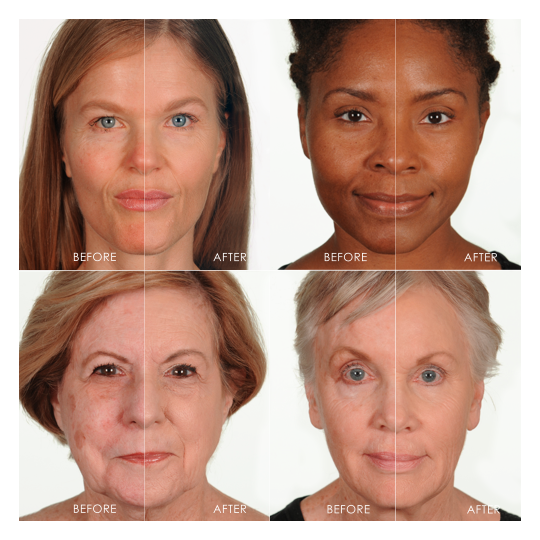 different before and afters for Light/Medium Perfect Canvas Airbrush Foundation 6-pack