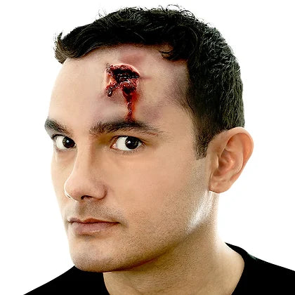 Image of Woochie .38 Exit wound