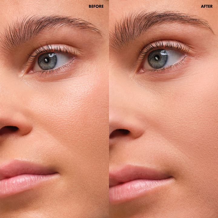 Before and after comparison of a woman's eye area with a focus on skin texture and color.