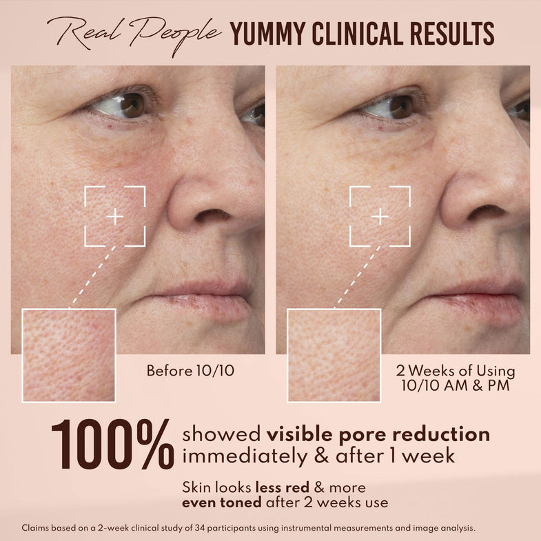 Before and after comparison of skin texture with text about clinical results and product usage.