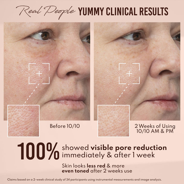 Before and after comparison of skin texture with text about clinical results and product usage.