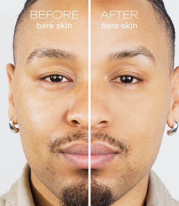 Before and after comparison of a man's face with bare skin on a plain background