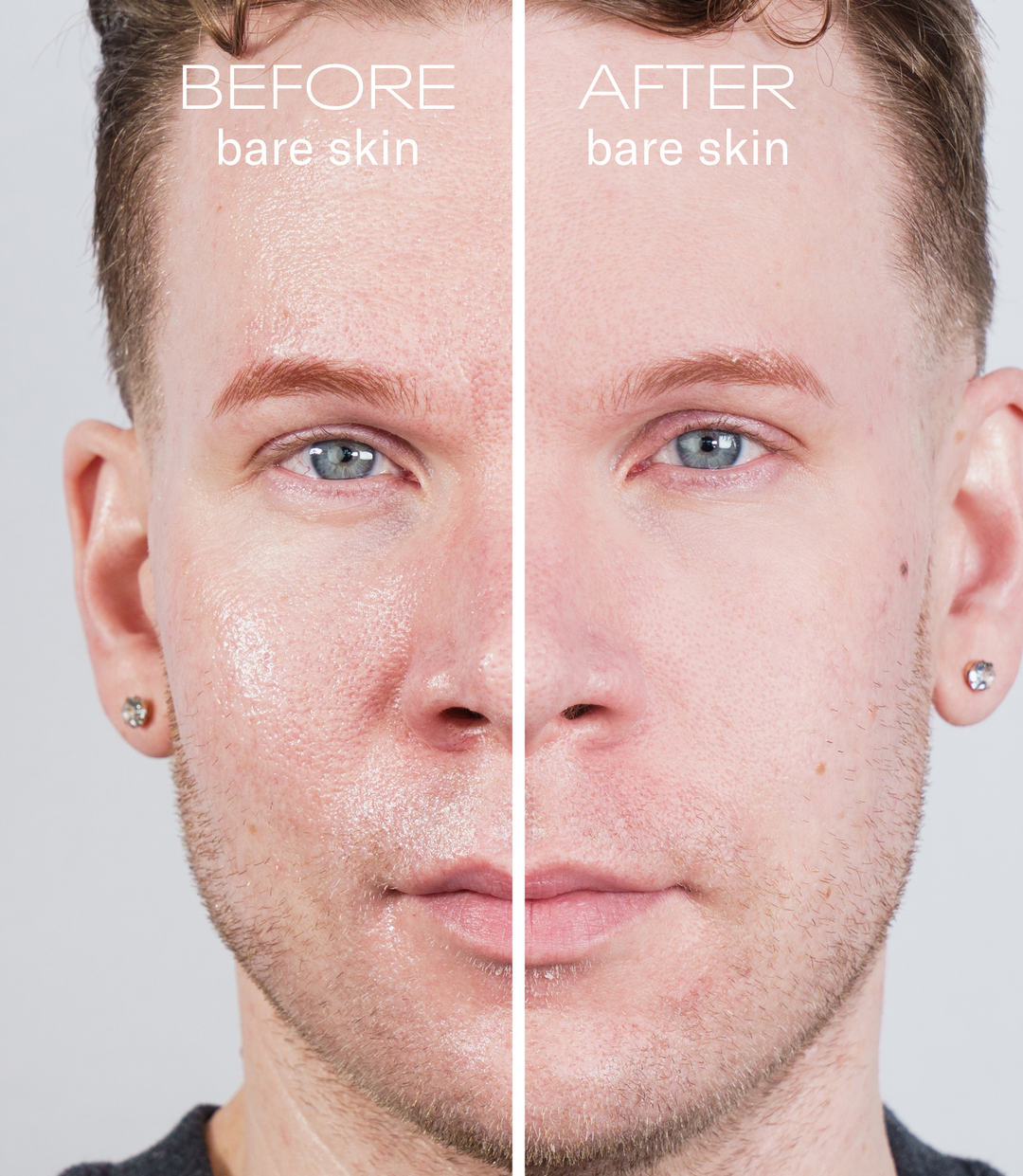 Before and after comparison of a man's face with bare skin on a plain background