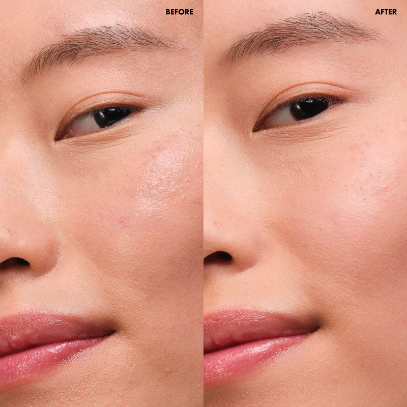 Before and after comparison of a person's eye area with visible skin improvement.
