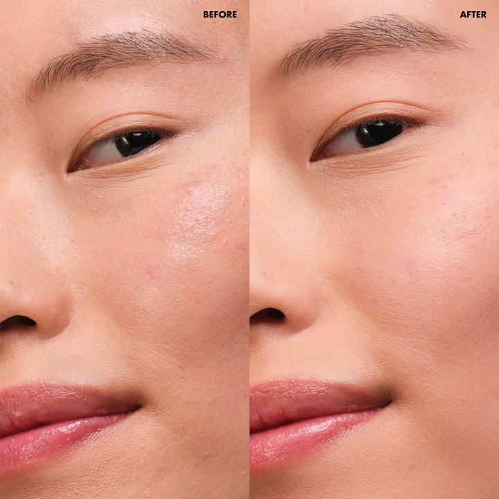 Before and after comparison of a person's eye area with visible skin improvement.